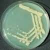 Dilution of bacteria on an agar plate