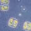 Pacific diatoms and bacteria